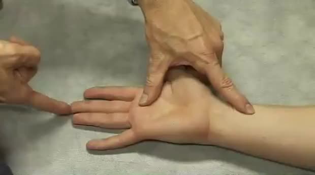 Trigger finger