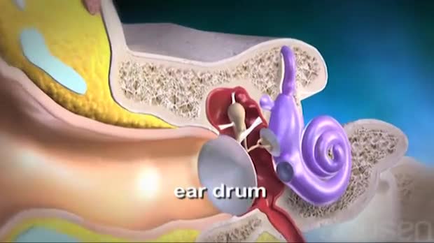 Hearing Loss