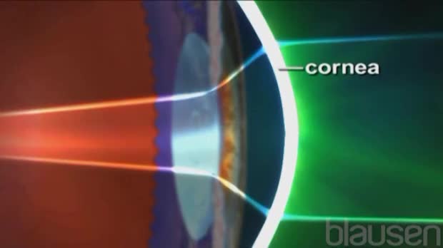 Near /Far Sightedness