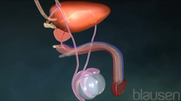 Cancro alla prostata